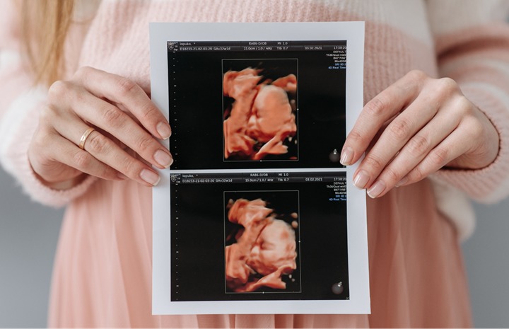 Obstetricia y Embarazo